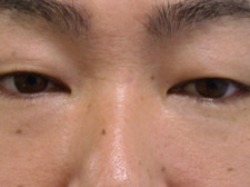 case_care2_008