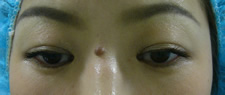 case_care2_009
