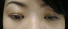 case_care2_010