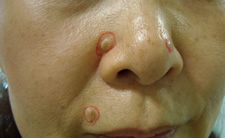 case_care2_011