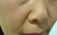 case_care2_012