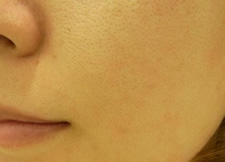 case_care3_002
