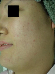 case_care3_003