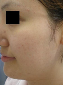 case_care3_004