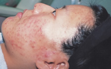 case_care3_005