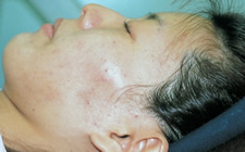 case_care3_006
