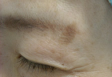 case_care_001
