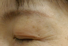 case_care_002
