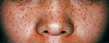 case_care_003