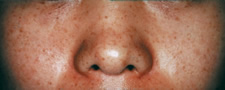 case_care_004