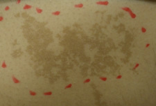 case_care_005