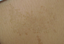 case_care_006