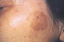 case_care_007