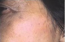 case_care_008