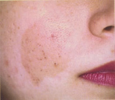 case_care_009