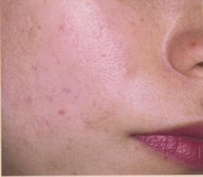 case_care_010