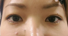 case_eye2_002