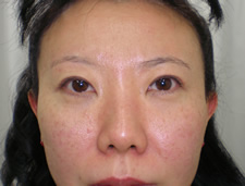 case_eye2_008