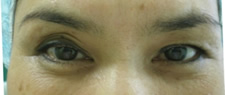case_eye2_009