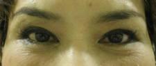 case_eye2_010