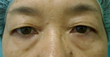 case_eye2_013