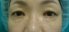case_eye2_015