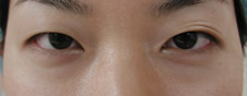 case_eye2_017