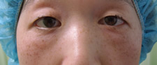 case_eye2_021