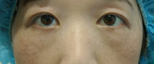case_eye2_022