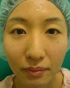 case_eye2_028