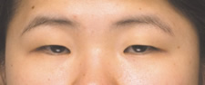 case_eye2_029