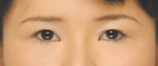 case_eye2_030