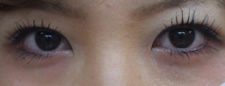case_eye3_003
