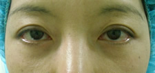 case_eye_004