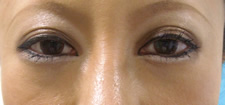 case_eye_008