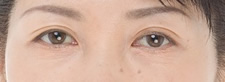 case_eye_012