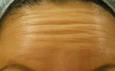 case_face2_001