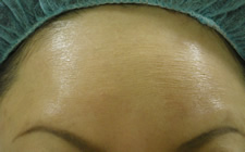 case_face2_002