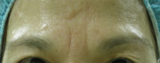 case_face2_003