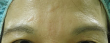 case_face2_004