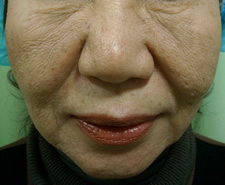 case_face2_007
