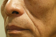 case_face2_009