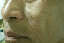 case_face2_010