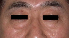 case_face2_011