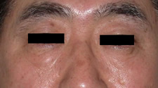 case_face2_012
