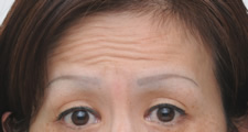 case_face2_013