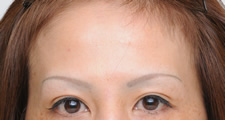 case_face2_014