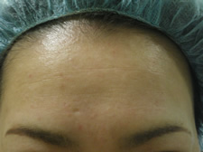 case_face2_015