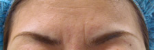 case_face2_017