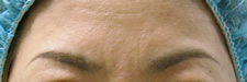 case_face2_018
